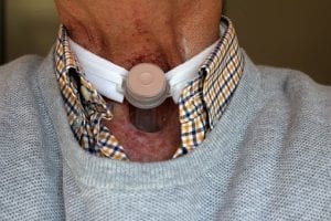 Tracheostomy care involves changing the ties and cleaning around the tracheostomy opening.